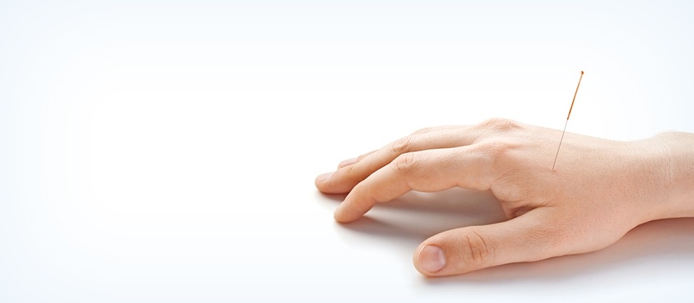 acupuncture